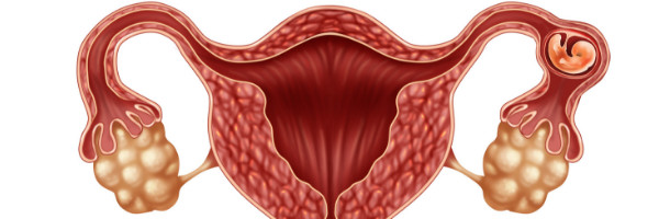 hormona antimulleriana y fertilidad