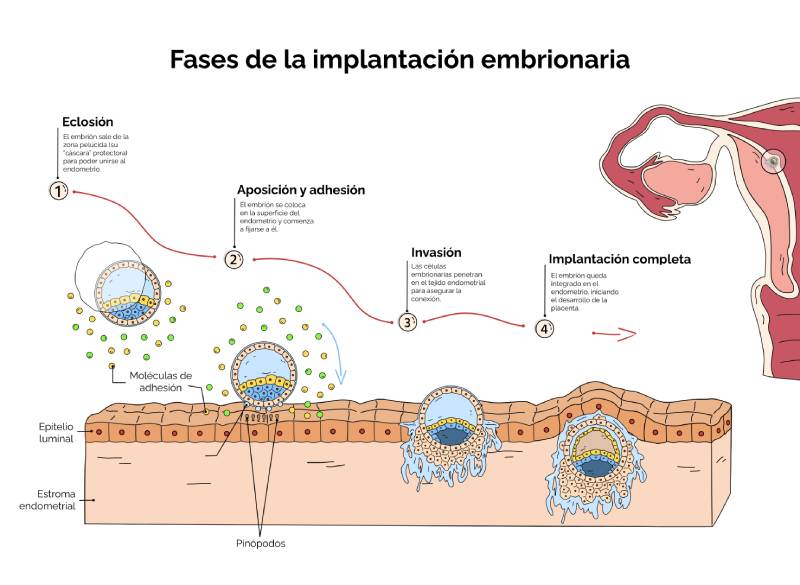 Fases de la implantación