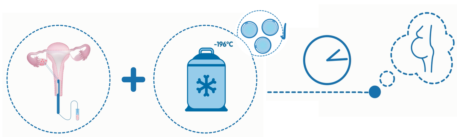 Vitrificación de los ovocitos