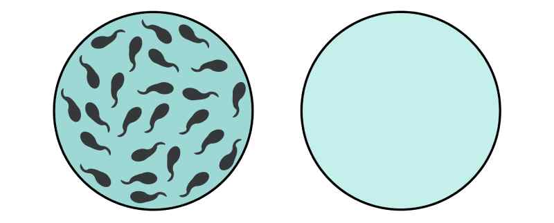 azoospermia